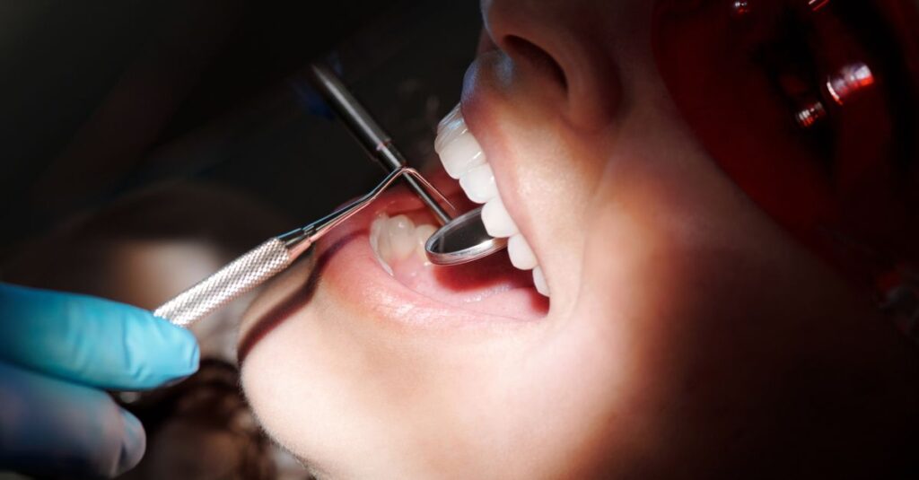 Diş Çürüğü Nasıl Anlaşılır? Çürüğün İlk Belirtileri Nelerdir?